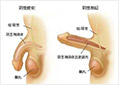 性功能障碍症状